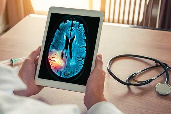 Doctor examines brain lesion on a tablet